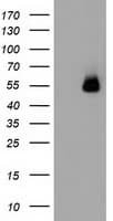 SQSTM1 Antibody (clone OTI4G9)