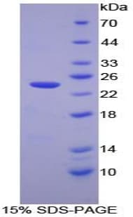 Human CASP7 / Caspase 7 Protein (Recombinant His-T7)