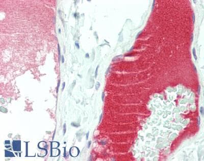 IHC-plus™ LDL / Low-Density Lipoprotein Antibody