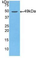 ENO2 / NSE Antibody (aa2-434)