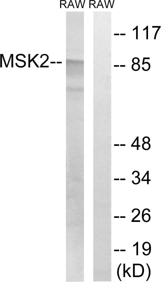 RPS6KA4 / MSK2 / RSK-B Antibody (aa531-580)