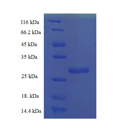 Human FGF1 / Acidic FGF Protein (Recombinant His-SUMO)