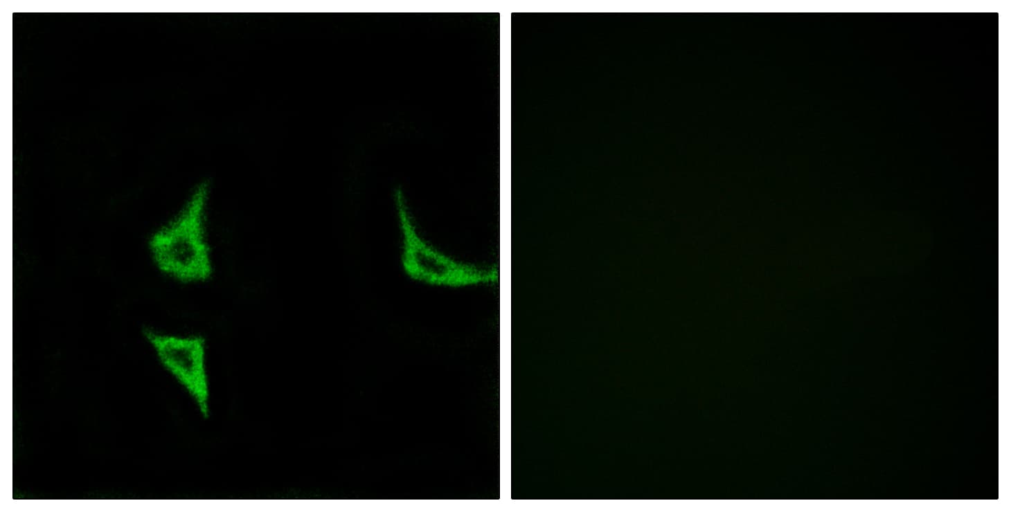 CAMK2 / CAMKII Antibody (phospho-Thr286)