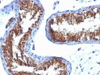 MVP / VAULT1 Antibody (clone 1032, Ready-to-Use)