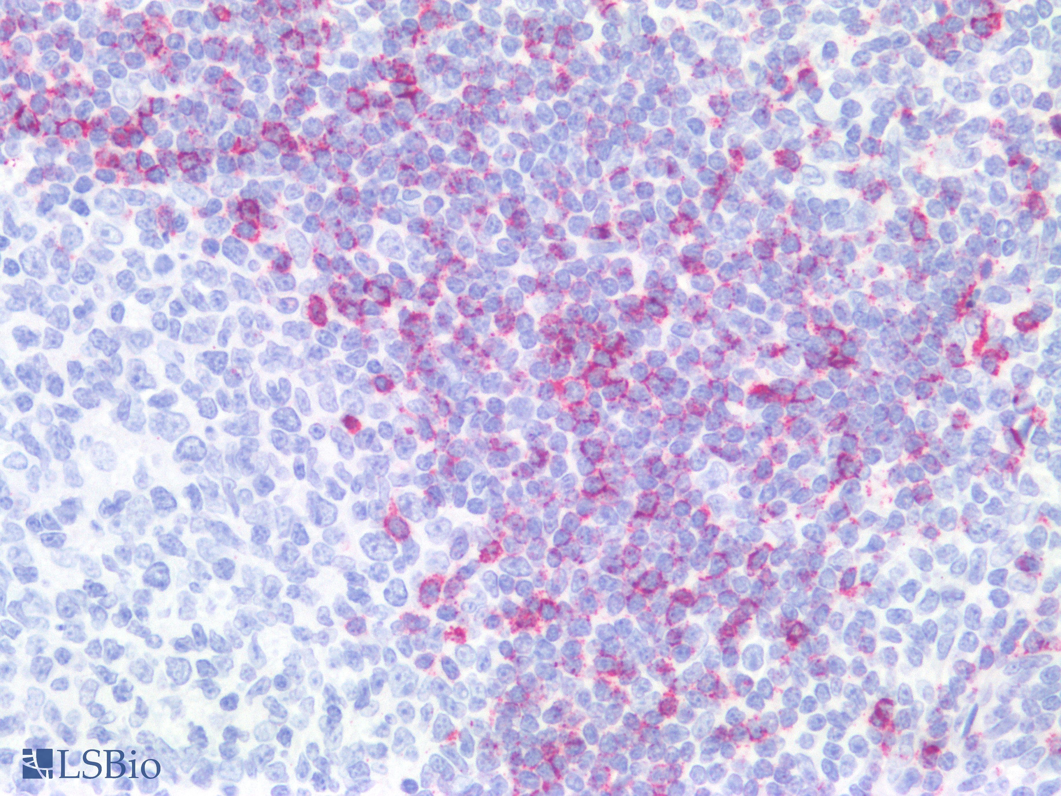 PathPlus™ Monoclonal Mouse anti-Human Hairy Cell Leukemia Antibody (Concentrated, IHC)