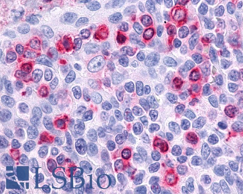 PathPlus™ Polyclonal Rabbit anti-Human CCR7 Antibody (N-Terminus, IHC)
