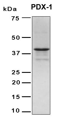 Human PDX1 Protein (Recombinant 6His, N-terminus)