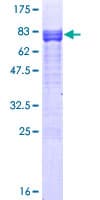Human ETS1 / ETS-1 Protein (Recombinant GST)