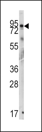 Polyclonal Rabbit anti-Human GIT1 Antibody (Tyr510, IHC, WB)