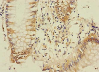 DUSP16 / MKP7 Antibody