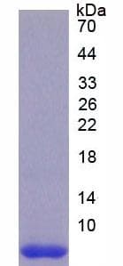 Rat TMSB4X / Thymosin Beta-4 Protein (Recombinant His)