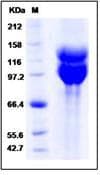 Human ITGAV + ITGB6 Heterodimer Protein (Recombinant DDK (Flag)-His, C-terminus)