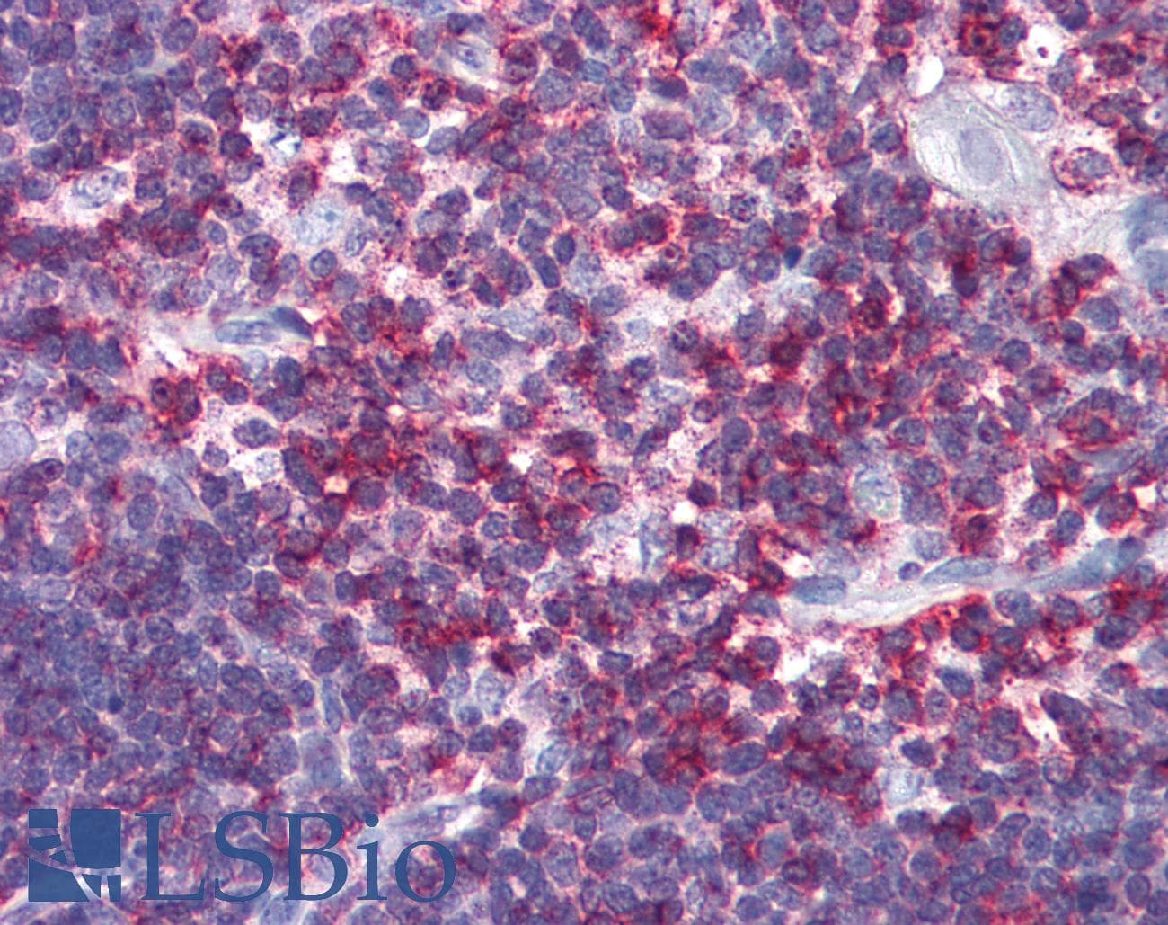 PathPlus™ Polyclonal Rabbit anti-Human CD45 / LCA Antibody (C-Terminus, IHC)
