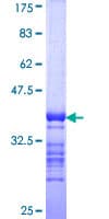 Human TG / Thyroglobulin Protein (Recombinant GST, N-terminus)