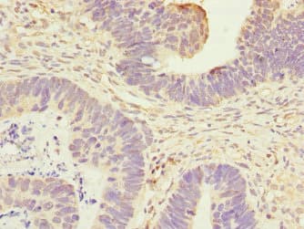 ANTXR2 / CMG2 Antibody