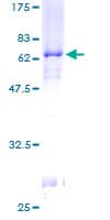 Human PITX2 / RGS Protein (Recombinant GST)