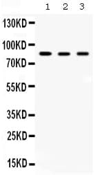 Polyclonal Rabbit anti-Human ACO2 / Aconitase 2 Antibody (WB)