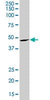 SRF / Serum Response Factor Antibody (clone 4D2)