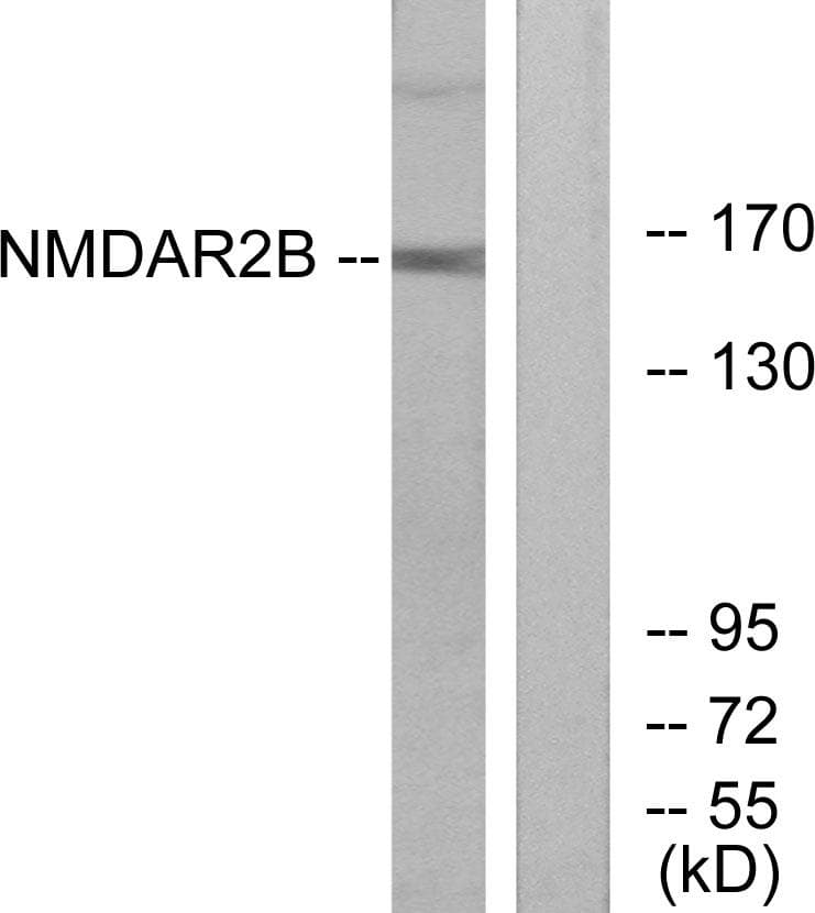 Polyclonal Rabbit anti-Human GRIN2B / NMDAR2B / NR2B Antibody (p1474, WB)