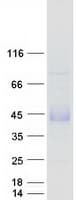 Human FST / Follistatin Protein (Recombinant Myc-DDK (Flag))