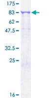 Human RPN1 / Ribophorin I Protein (Recombinant GST)
