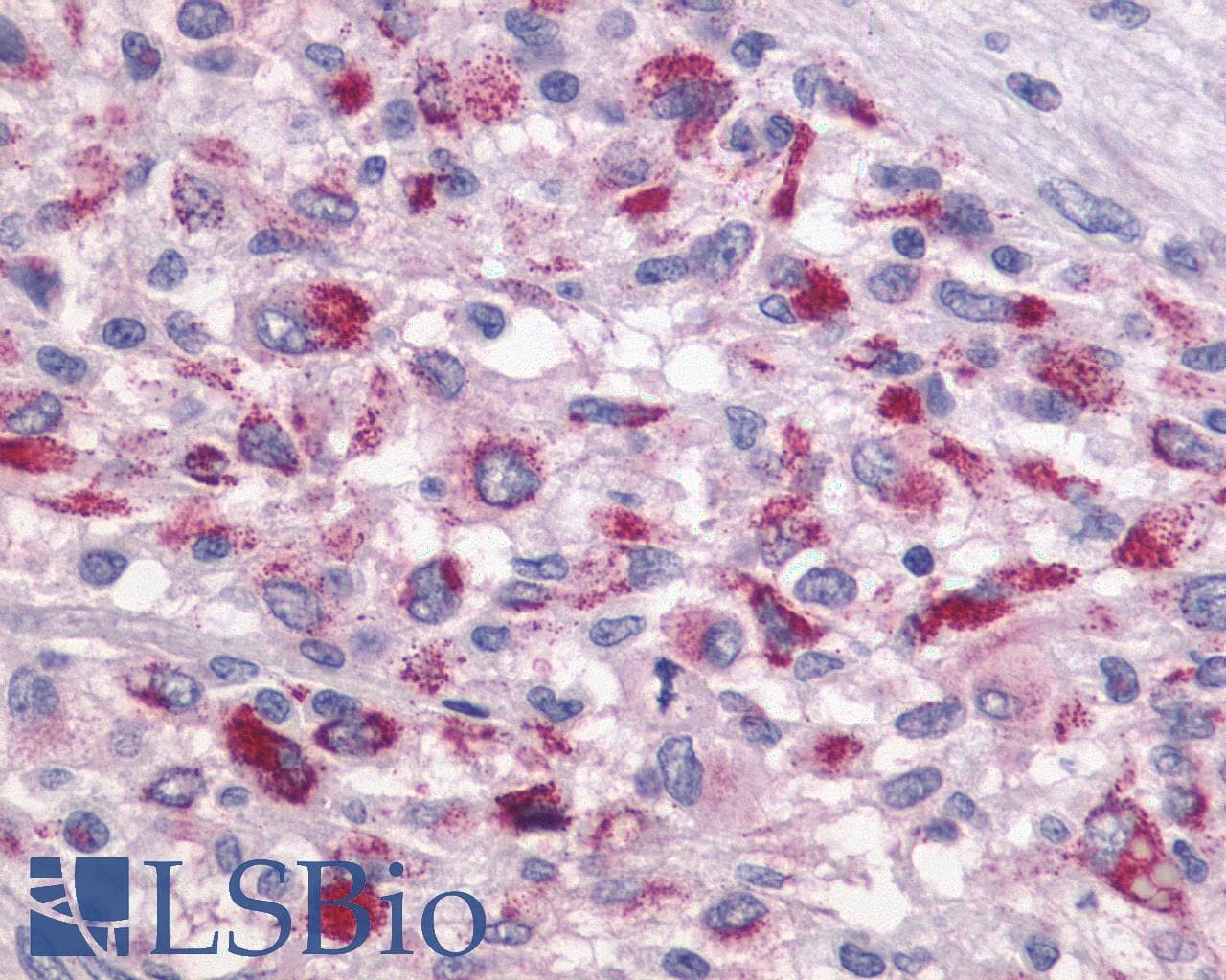 PathPlus™ TAAR1 / TA1 Antibody (Cytoplasmic Domain)