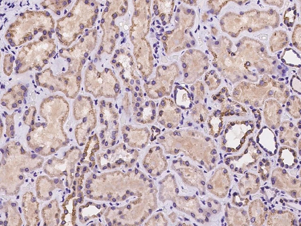 STAMBP / AMSH Antibody
