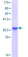 Human NPHS1 / Nephrin Protein (Recombinant GST, N-terminus)
