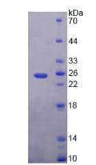 Human PEBP1 / RKIP Protein (Recombinant His-T7)