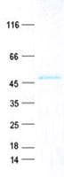 Human FSP27 / CIDEC Protein (Recombinant GST, N-terminus + His, C-terminus)