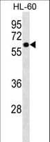 ZNF649 Antibody (aa84-112)