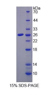 Human CETP Protein (Recombinant His, N-terminus)