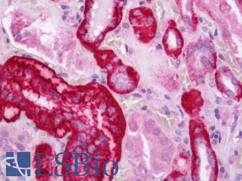 IHC-plus™ BCOR Antibody (aa25-75)