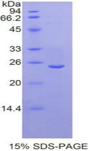Mouse USAG1 / SOSTDC1 Protein (Recombinant His-T7)