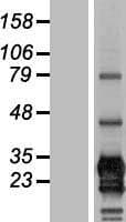 Human CD79B / CD79 Beta Protein (Over-Expression Lysate Myc-DDK (Flag))