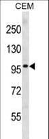 PR / Progesterone Receptor Antibody (aa523-550)
