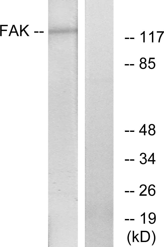 FAK / Focal Adhesion Kinase Antibody (aa828-877)