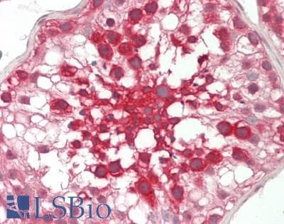 IHC-plus™ METAP2 Antibody (aa100-150)
