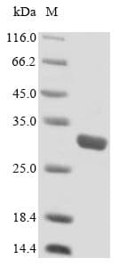 Human SLC25A20 / CACT Protein (Recombinant GST, N-terminus)