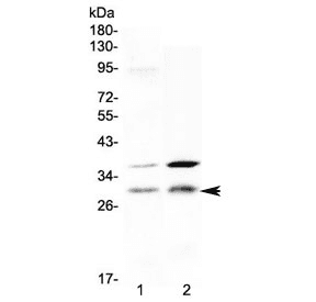 HOXA5 Antibody
