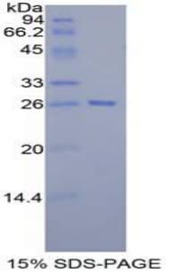 Mouse TAZ Protein (Recombinant His-T7)