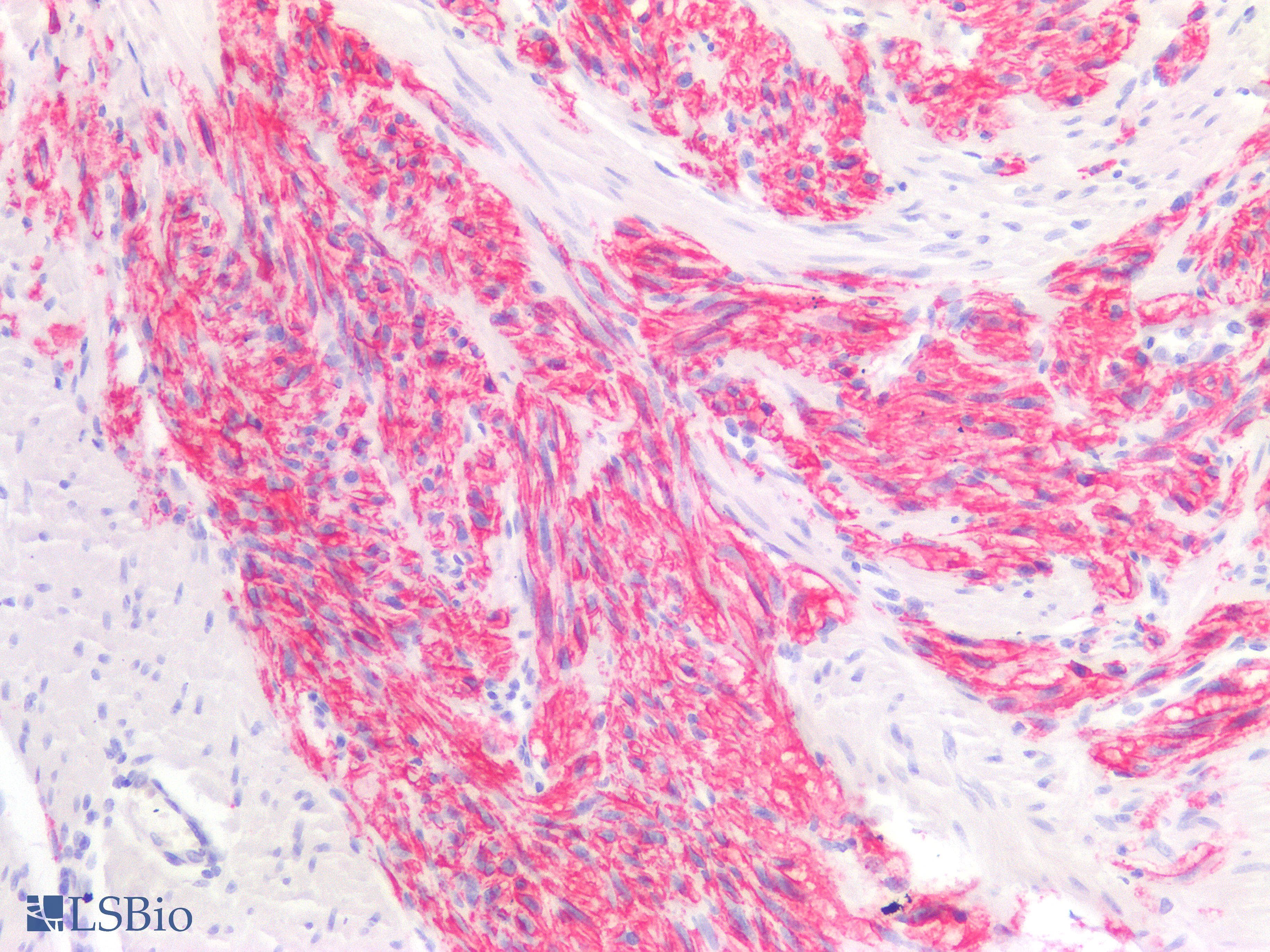 PathPlus™ Recombinant Monoclonal Rabbit anti-Human ANO1 / DOG1 / TMEM16A Antibody (clone DG1/2564R, aa 2-101, IHC)