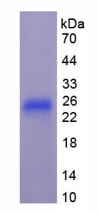 Rat FGF21 Protein (Recombinant His, N-Terminal)