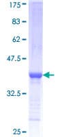 Human SPTLC2 / LCB2 Protein (Recombinant GST, N-terminus)