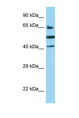 CD2 Antibody (aa227-276)