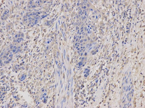 IHC-plus™ Polyclonal Rabbit anti-Human PRKAR1A Antibody (IHC, IF, WB)