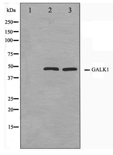 GALK1 / GK1 Antibody