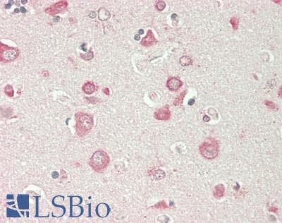 IHC-plus™ Polyclonal Rabbit anti-Human PTPRR Antibody (aa 1-412, IHC)