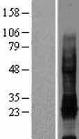 Human IL32 Protein (Over-Expression Lysate Myc-DDK (Flag))