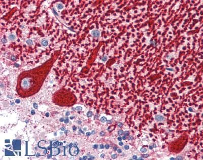 IHC-plus™ Polyclonal Rabbit anti-Human SLC1A6 / EAAT4 Antibody (IHC, WB)